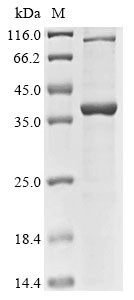 40S ribosomal protein S4, Y isoform 1 (RPS4Y1), human, recombinant