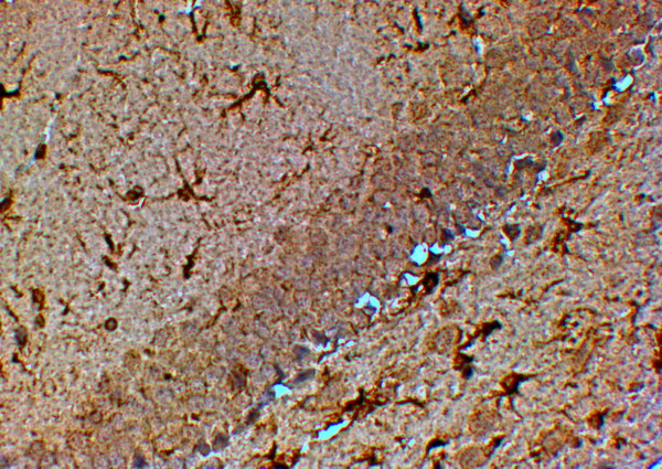Anti-TRPM7 / LTRPC7, C-terminal