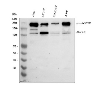 Anti-IGF1R / Insulin-like growth factor 1 receptor