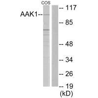Anti-AAK1