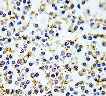 Anti-ALDH1A3