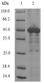 N-alpha-acetyltransferase 50 (NAA50), human, recombinant