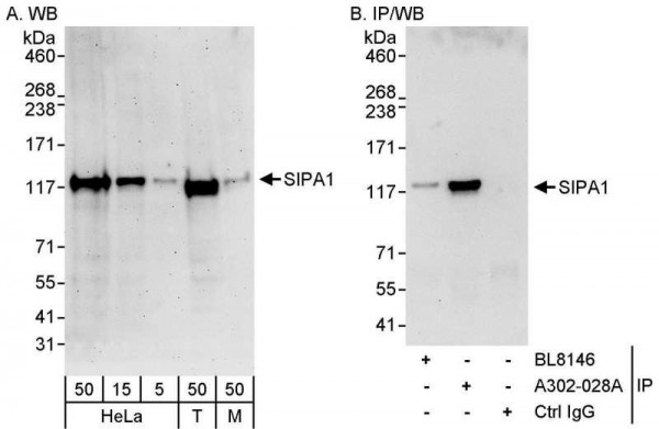 Anti-SIPA1