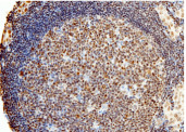 Anti-PARP-1/PARP Monoclonal Antibody