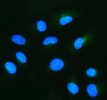 Anti-NUDT9 / ADP-ribose pyrophosphatase