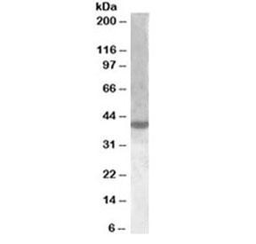 Anti-XBP1