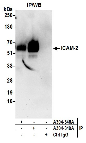 Anti-ICAM-2