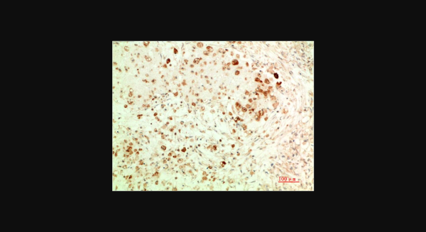 Anti-ATG5 (3C7), monoclonal