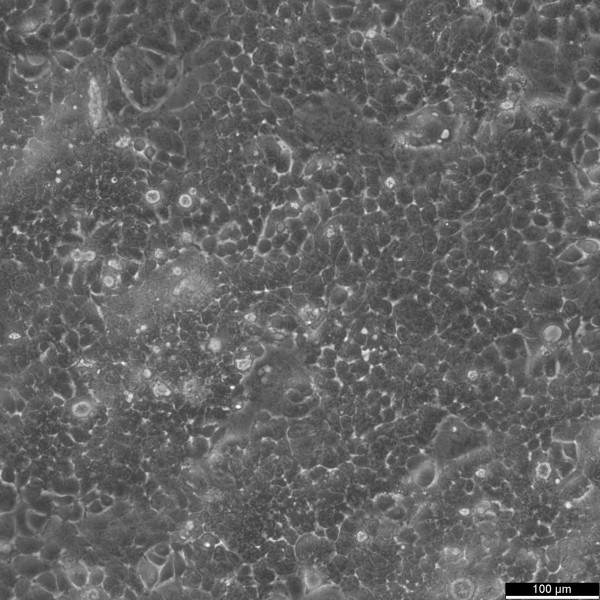 HARA-B Cells