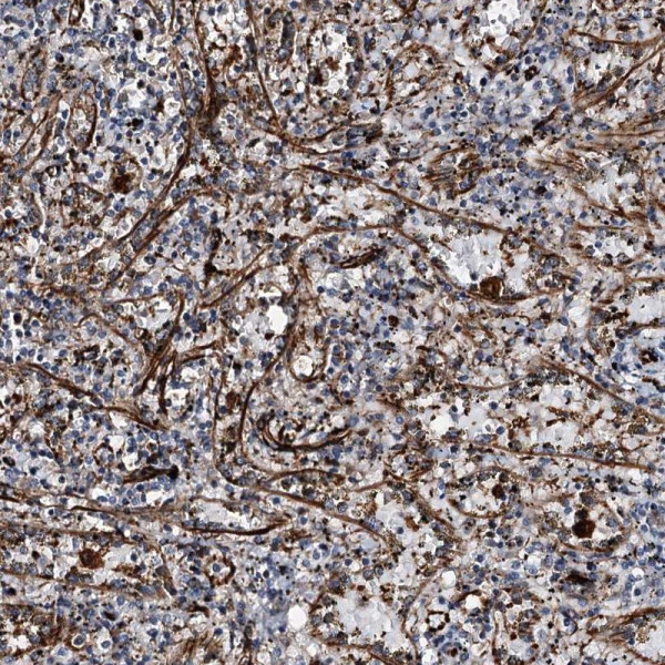 Anti-DPEP2