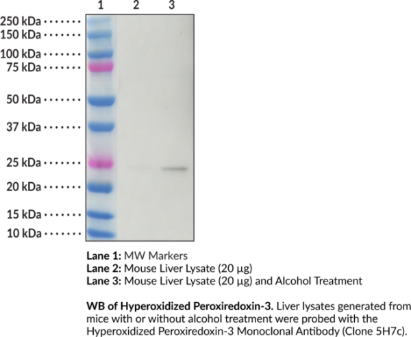 Anti-Hyperoxidized Peroxiredoxin-3 (Clone 5H