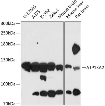 Anti-ATP13A2