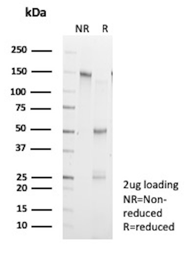 Anti-Creatine Kinase MM (Biomarker for Muscular Injury &amp; Cardiac Damage), recombinant antibody, clon