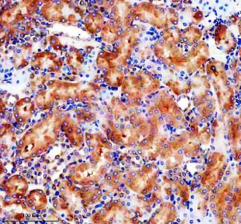 Anti-GLB1 / Beta galactosidase, clone 25G11