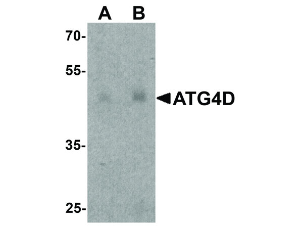 Anti-ATG4D