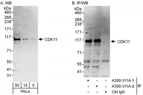 Anti-CDK11