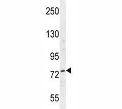 Anti-Nucleolin