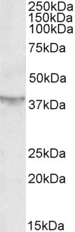 Anti-SIRT4, C-terminal