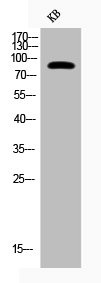 Anti-Phospho-CHUK (T23)