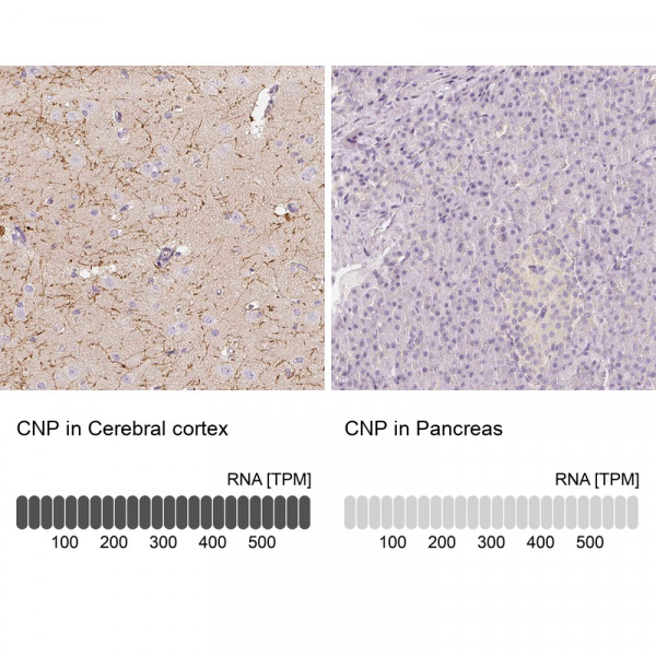 Anti-CNP