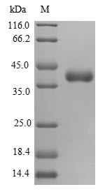 28S ribosomal protein S16, mitochondrial (MRPS16), human, recombinant