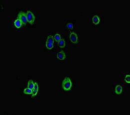 Anti-ATP8B1