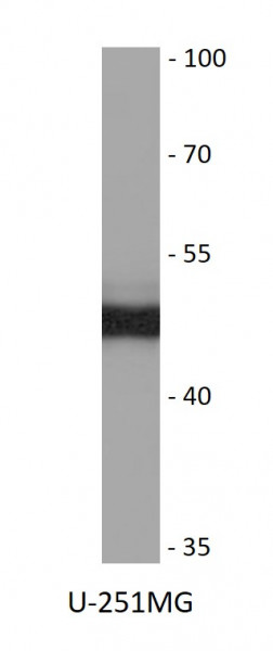 Anti-INPP1