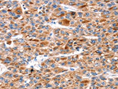 Anti-KCNH6