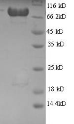 AP-2 complex subunit mu (AP2M1), human, recombinant