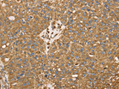 Anti-RRBP1