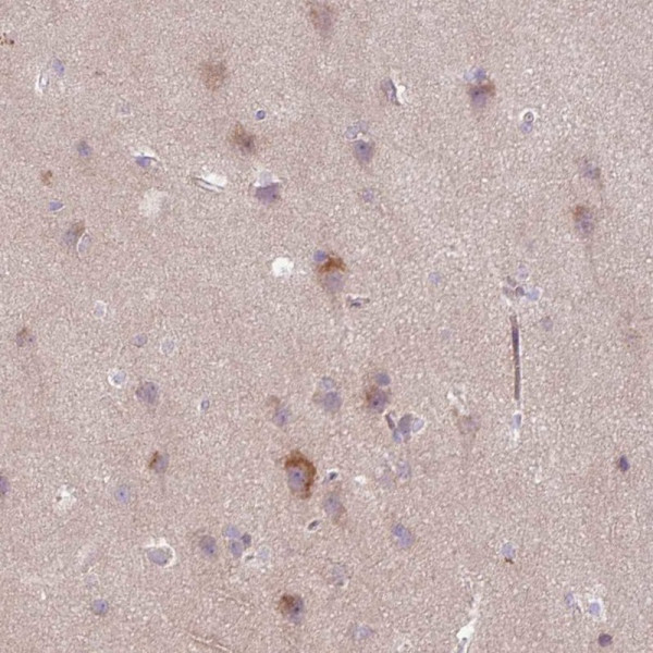 Anti-ARHGEF25