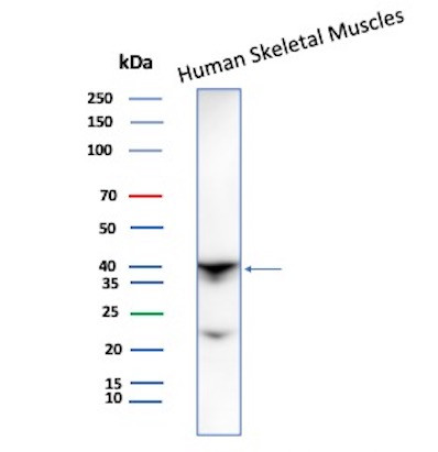 Anti-BRAF (V600E Mutant Specific) (Prognostic Marker), clone V600E/1321