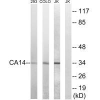 Anti-CA14