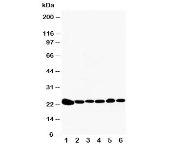 Anti-Peroxiredoxin 2 (PRDX2)