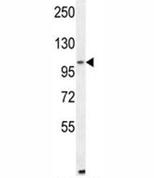 Anti-ALDH1L2