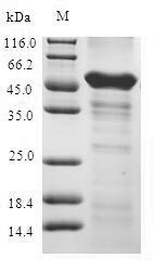 1-Acylglycerol-3-phosphate O-acyltransferase ABHD5 (ABHD5), human, recombinant