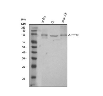 Anti-MELTF / Melanotransferrin / MFI2