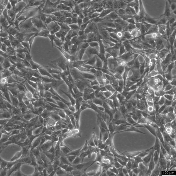 NCI-H1975 Cells