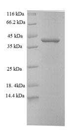 Cyclin-dependent kinase 2-associated protein 1 (CDK2AP1), human, recombinant