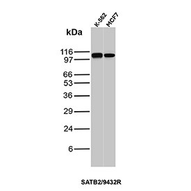 Anti-SATB2 / DNA-binding protein SATB2, clone SATB2/9432R