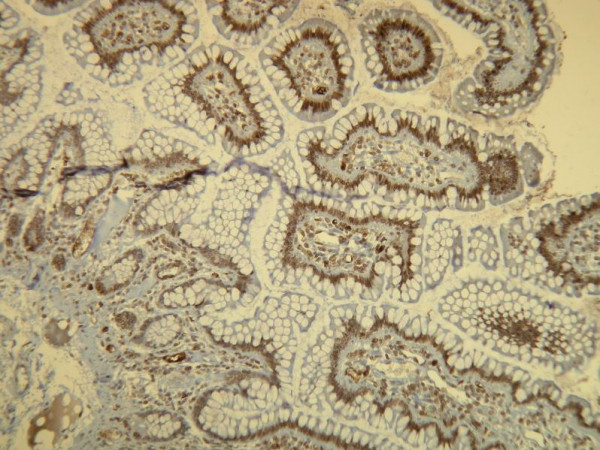 Anti-B-raf, clone G11-G