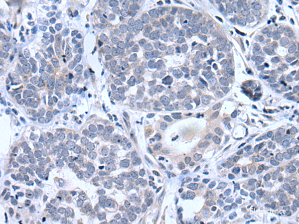 Anti-BTG4