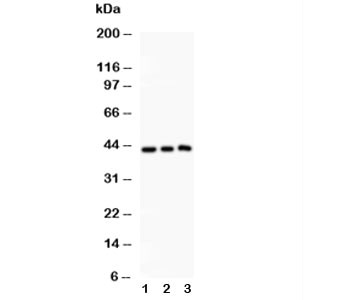 Anti-SIRT2