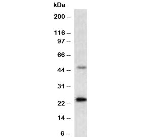 Anti-Mammaglobin A / SCGB2A2, clone MMGA-1R