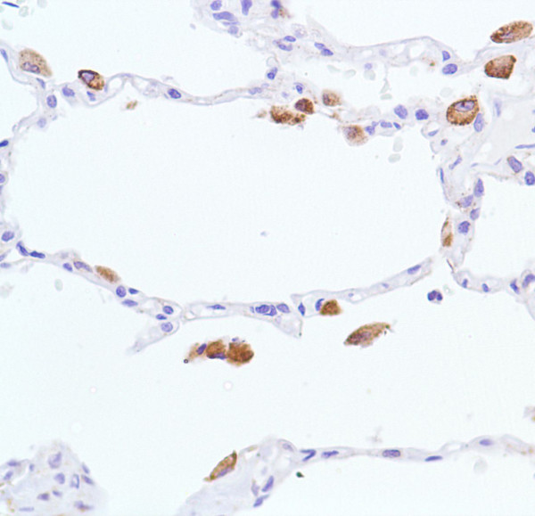 Anti-Nitric Oxide Synthase-Inducible (iNOS), clone SP126