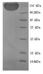 Podocalyxin (Podxl), partial, rat, recombinant