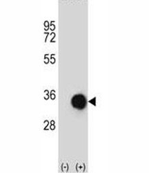 Anti-Caspase-6