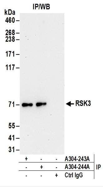 Anti-RSK3