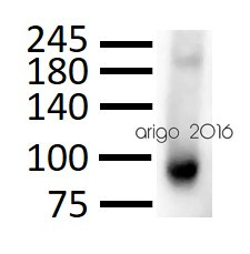 Anti-CD105, clone MEM-226
