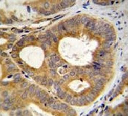 Anti-TRPM8